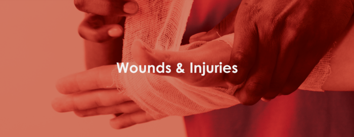 injured hand treatment